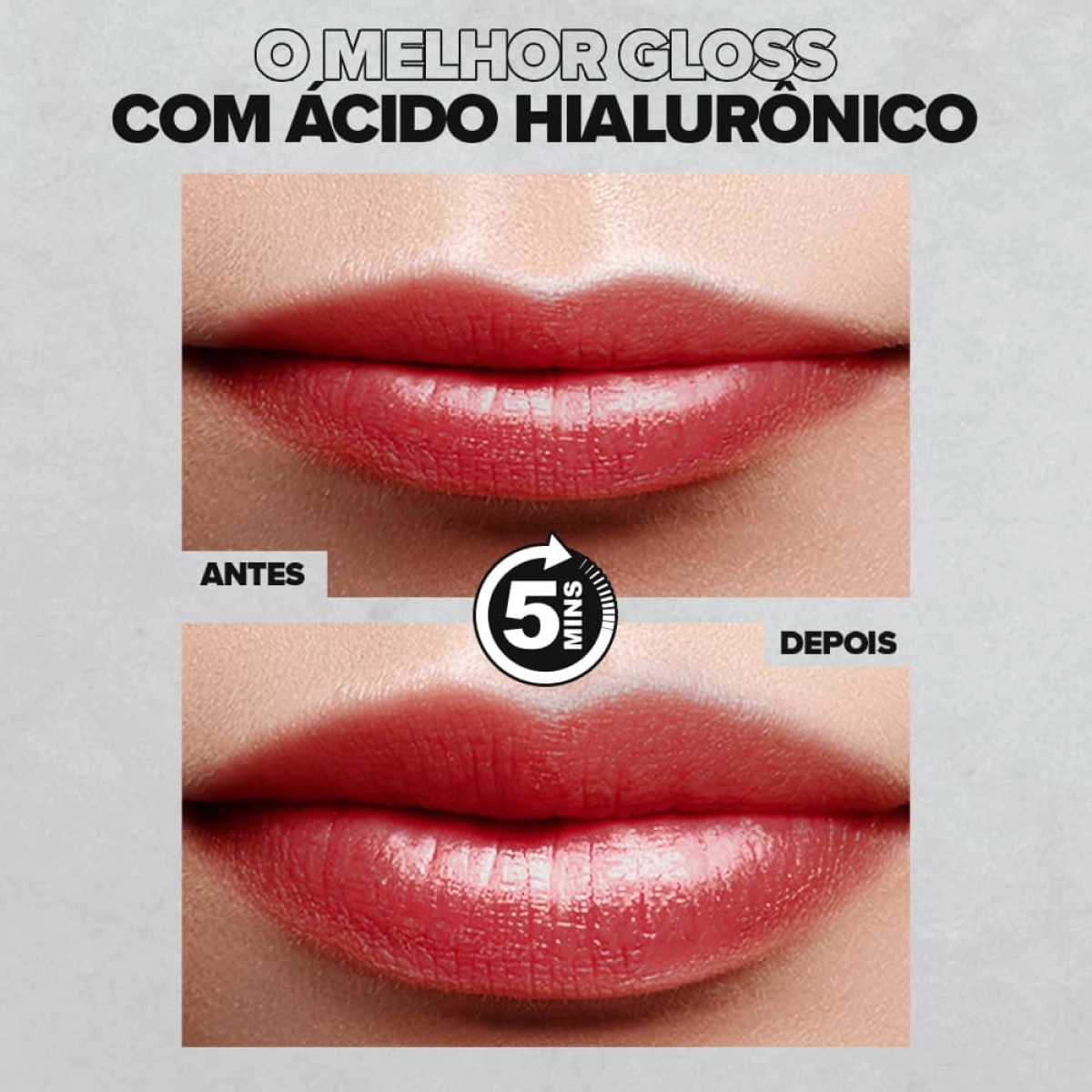 Monte seu Kit Gloss Labial com Ácido Hialurônico e Sérum da Up Lips e fique linda e com um bocão de arrasar! Monte seu Kit Gloss Labial com Ácido Hialurônico e Sérum da Up Lips e fique linda e com um bocão de arrasar!