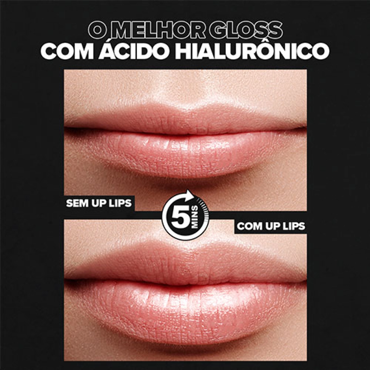 Monte seu Kit Gloss Labial com Ácido Hialurônico e Sérum da Up Lips e fique linda e com um bocão de arrasar!